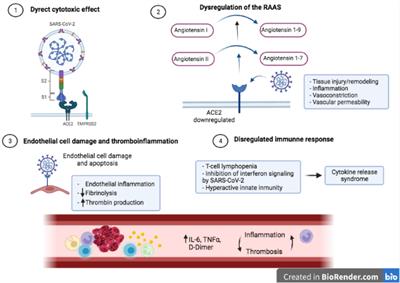 Myocardial Injury in COVID-19 and Its Implications in Short- and Long-Term Outcomes